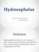 Image result for Hydrocephalus Concept Map