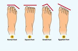 Image result for 3 Arches of the Foot