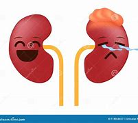 Image result for Kidney Cancer Tumor