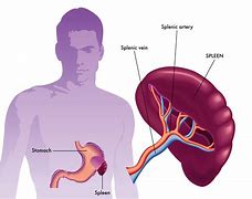 Image result for Spleen Disease Symptoms