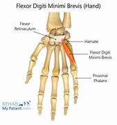 Image result for M Flexor Digiti Minimi Brevis