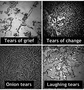 Image result for Grief Tears Under Microscope