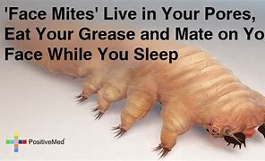 Image result for Face Mites in Pores