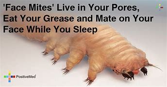 Image result for Mites That Live On Your Face