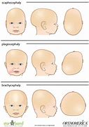 Image result for Helmet Head Shape Chart