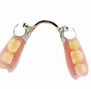 Image result for Metal-Based Partial Dentures