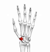 Image result for Capitate Bone Pain