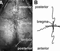 Image result for Bregma Skull Sutures