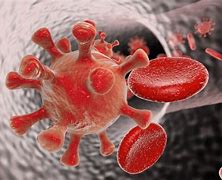 Image result for Gambar Gejala HIV