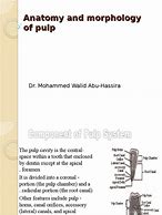 Image result for Pulp Anatomy