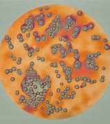 Image result for Dry Saccharomyces Cerevisiae