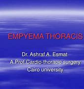 Image result for Thoracic Empyema