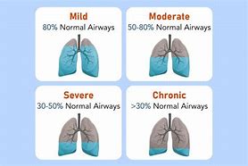 Image result for COPD Amboss