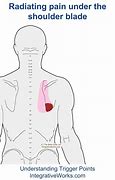 Image result for Muscle Under Shoulder Blade