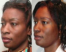 Image result for African American Nose vs African Nose