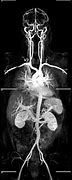 Image result for Whole Body MRI Angio