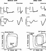 Image result for Ed's Tip 4 Angio RMN