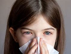 Image result for Allergic Conjunctivitis Treatment