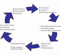 Image result for Acute Pulmonary Oedema and Fluid Overload