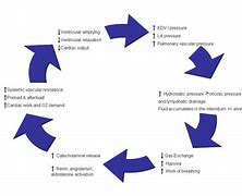 Image result for Acute Lung Oedema