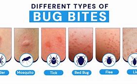 Image result for Fungi Bites and Stings