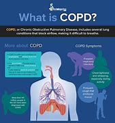 Image result for COPD Pinterest