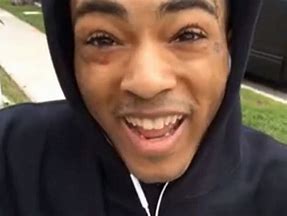 Image result for Xxxtentacion Mad Face