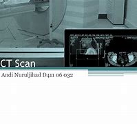 Image result for CT Scan Image for PPT