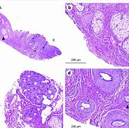 Image result for Tarsal Conjunctiva Papillae