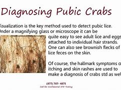 Image result for Crabs Infection