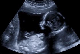 Image result for 13 week baby development