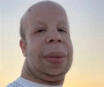 Image result for Albino Meme