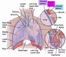 Image result for Pleural Infection