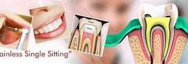 Image result for Tooth Extraction Painless