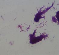 Image result for Mycobacterium GM's Stain