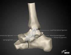 Image result for Deltoid Ligament Repair