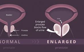 Image result for Shape of Prostate