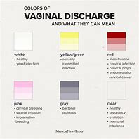 Image result for Gray Discharge