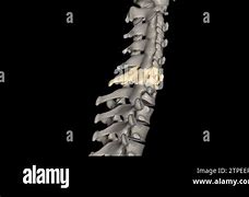 Image result for C6 Spinal