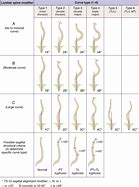 Image result for Degree of Curvature