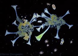 Image result for Stentor Protozoa