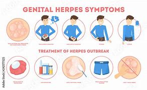 Image result for Herpes Genitalis