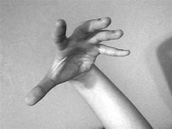 Image result for Dramatic Hand Poses