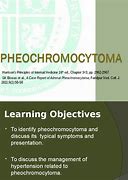 Image result for Pheochromocytoma Presentation