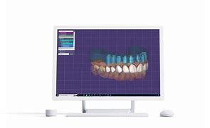 Image result for Dental Lab Table