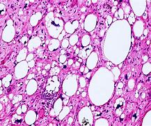 Image result for Pathology Images