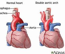 Image result for Aortic Vessels