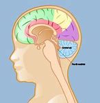 Image result for Medulloblastoma in Child