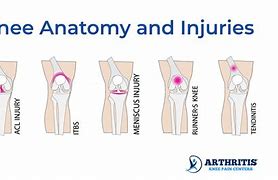 Image result for Left Knee