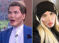 Image result for Plastic Surgery Boy to Girl